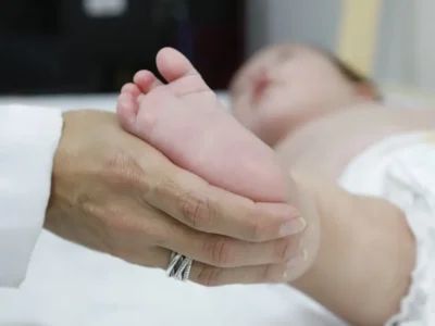 Atraso no teste do pezinho atrasa tratamento da AME no SUS
